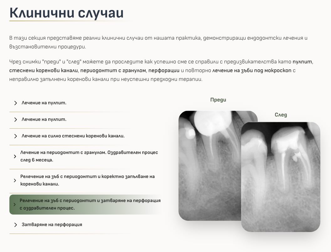 Дентално студио DentView Клинични случаи